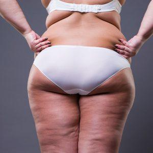 Porque Los Hombre No Tiene Celulitis.