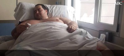 Superobesidad cada vez más frecuente en España