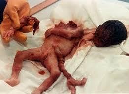 Aborto Vs Masturbación Vs Encanto Feromonal