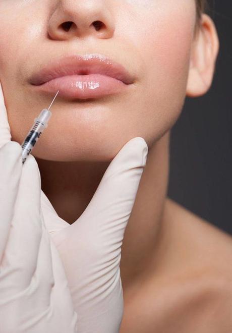 relleno de labios aumento de labios