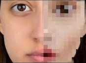 cirugia multiple rostro parte final