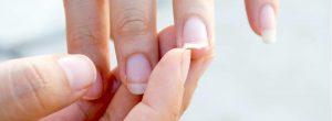 Lo que tus uñas pueden contarte sobre tu salud