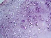 Artricenter: cosas deberías saber sobre cartílago