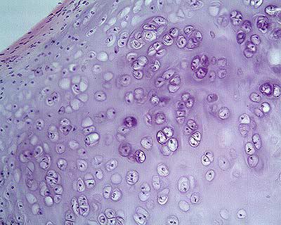 Artricenter: 10 cosas que deberías saber sobre el cartílago