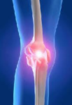 5 señales para reconocer a la osteoartritis dolor articular