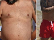 balón intragástrico cambia vida famosos famosos...