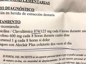 Miligramo arriba abajo