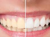 ☻Como remineralizar esmalte dientes