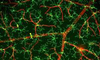 Las Microglia actúa en el Cerebro de manera diferente según el Sexo
