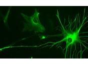 Descubren Celulas Cerebrales Altamente Neuroinflamantorias