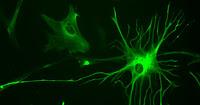 Descubren Celulas Cerebrales Altamente Neuroinflamantorias
