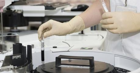 Un gran paso para prevenir la metástasis de cáncer colorrectal