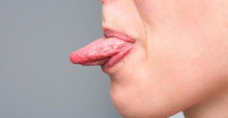 ¿Por qué aparecen las llagas en la lengua?
