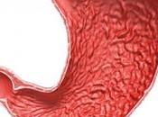 hombre tenía tó...