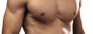 Solución para la ginecomastia