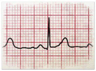 La importancia del electro para evitar una desgracia