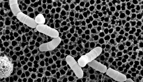 Propionibacterium  freudenreichii , Beneficios, usos y Contraindicaciones