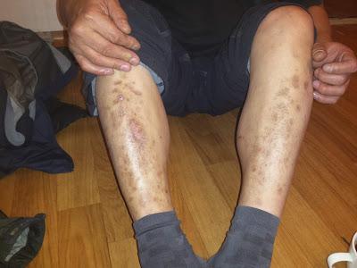 El hombre que quería estar en el olvido