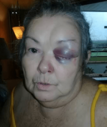 Estancia en hotel de Varadero se convierte en una pesadilla (+FOTOS)