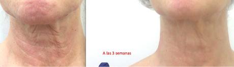 Medicina Estética: ¿Qué Puedo hacerme En Otoño, Doctor?