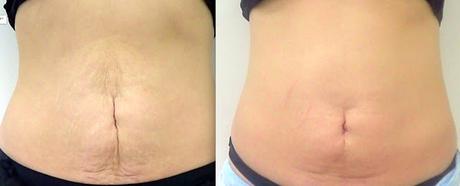 Medicina Estética: ¿Qué Puedo hacerme En Otoño, Doctor?