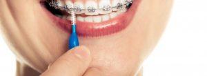 Cepillos de dientes interdentales