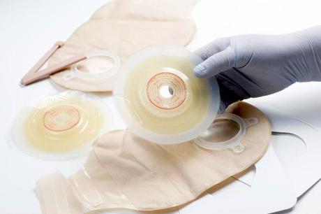 Las personas con ileostomía llevarán una bolsa externa que recoge las heces