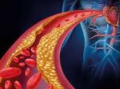Nueva Propuesta Terapia para Ateroesclerosis