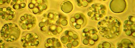 Microalga Schizochytrium: Omega 3 Vegano y Sostenible