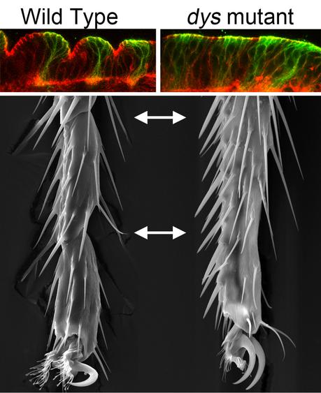 Pérdida de las articulaciones distales en mutantes dys