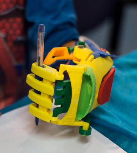 La historia de Gino Tubaro, que recorre el pais entregando protesis  3D