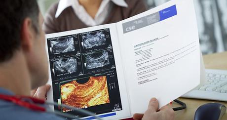 Fertilidad y quistes de chocolate (endometriomas ováricos): ¿qué necesita saber sobre el embarazo?