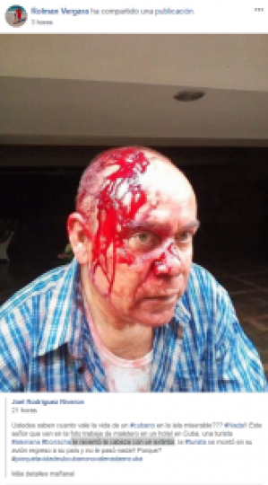 Turista alemana en Cuba le parte la cabeza a un cubano con un extintor