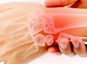 Trastornos movimiento repetitivo: ¿qué podría causar movimientos repetitivos muñeca cuello?