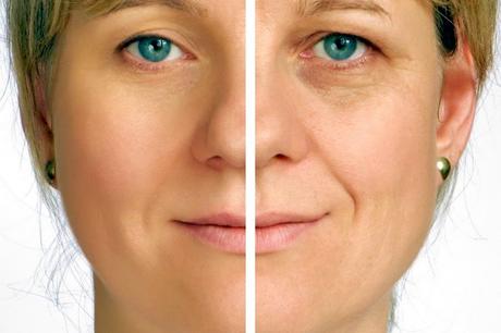 6 razones por las que puede tener arrugas prematuras y qué puede hacer al respecto