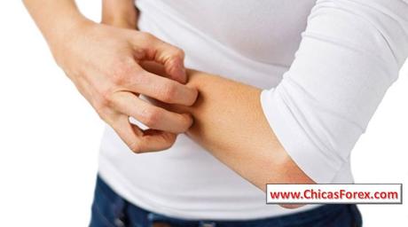 La Candidiasis y la Conexión con la Toxicidad de Metales