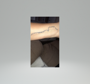 Diario De Una Migrante Venezolana. Marcado En La Piel.