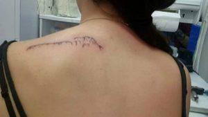 Diario De Una Migrante Venezolana. Marcado En La Piel.