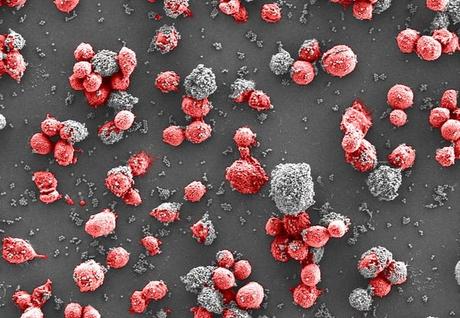 Una nueva arma contra el cáncer: los anticuerpos