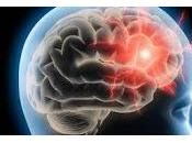 Nuevo Avance tratamiento daño cerebral