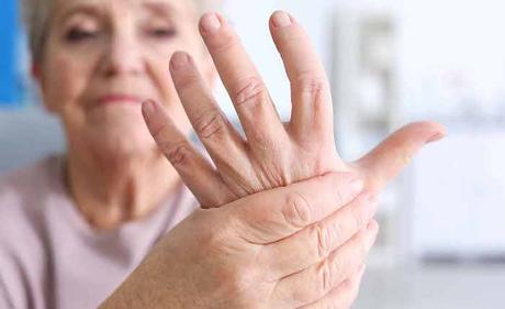 El dolor articular es un síntoma potencial de la colitis ulcerosa