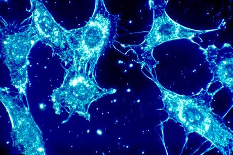 Un nuevo estudio aborda el desafío de la hipoxia en el cáncer