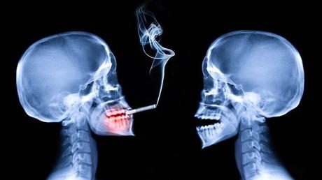 Fumar es un factor de riesgo clave para la AR