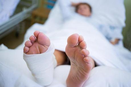 Una persona puede requerir una bota quirúrgica después de la cirugía de extracción de juanete