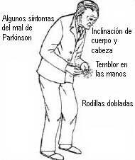 Nuevos avances en el Mal de Parkinson