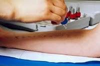 AEPNAA: Asociación Española de Alérgicos a Alimentos y Látex