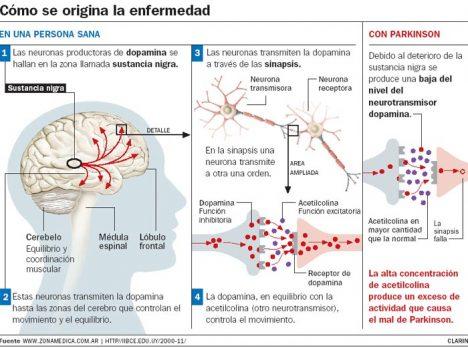 Día Internacional Del Parkinson