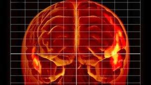 Trazar el mapa más detallado del cerebro
