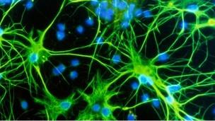 Trazar el mapa más detallado del cerebro