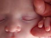 Heridas abiertas bebés